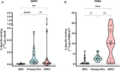 GRPR versus PSMA: expression profiles during prostate cancer progression demonstrate the added value of GRPR-targeting theranostic approaches